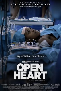 Open Heart Technical Specifications