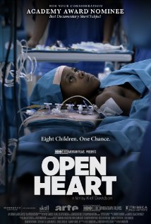 Open Heart | ShotOnWhat?